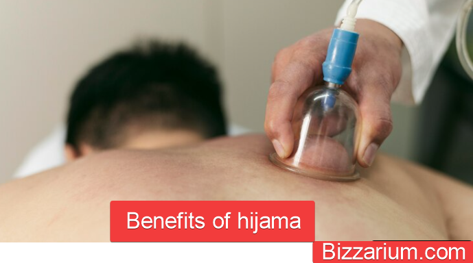 Benefits of Hijama